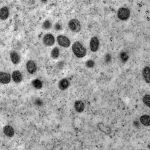 OMS alerta: Mpox reemerge como crise sanitária global