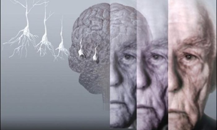 1449869909_depsicologia.com.wp-content.uploads.alzheimer_thumb