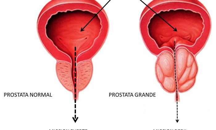 Anatomia-Laser-21