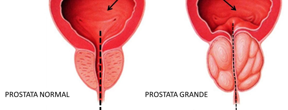 Anatomia-Laser-21