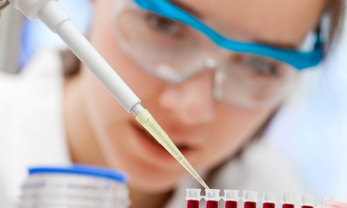 exame-sangue-alzheimer